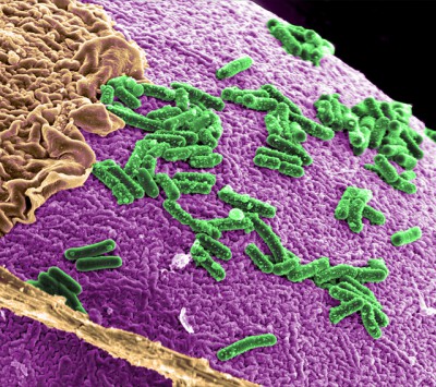 bakteri dalam sel usus manusia